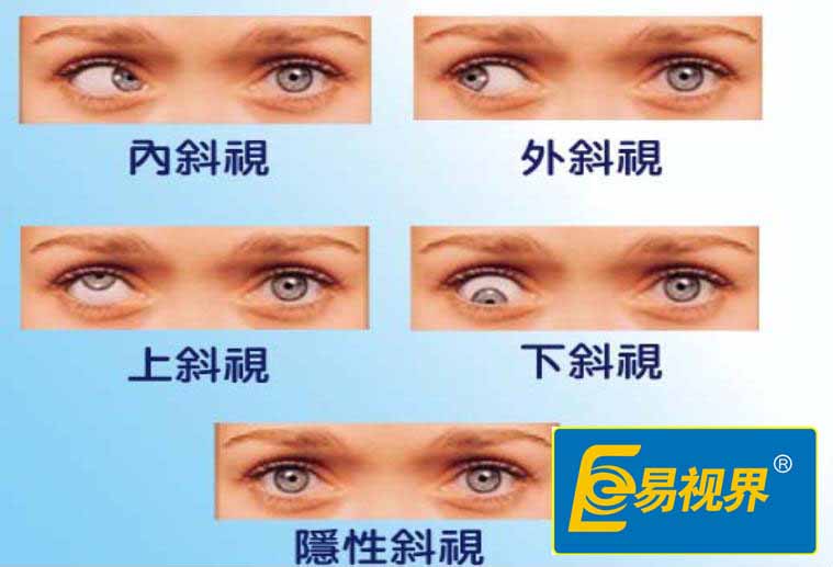 开云电子官方网站护眼专家：浅谈日常视力保护
